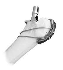 Pinax Prothesis OTHER – Home Orthopedics